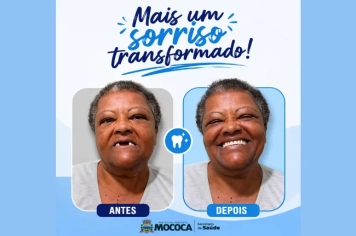  MOCOCA AVANÇA NA SAÚDE BUCAL: TRANSFORMANDO SORRISOS E VIDAS!